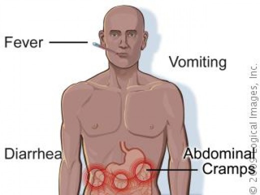 Typhoid_2.jpg